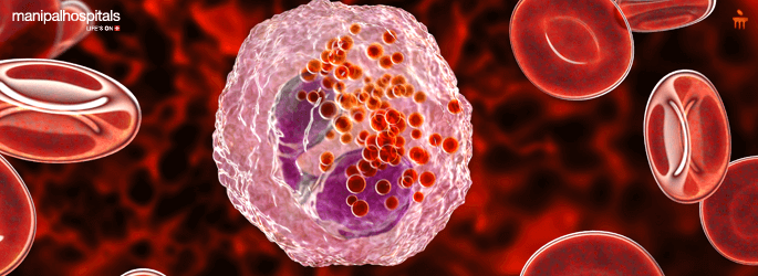 Blood Cancer Treatment in Vijayawada