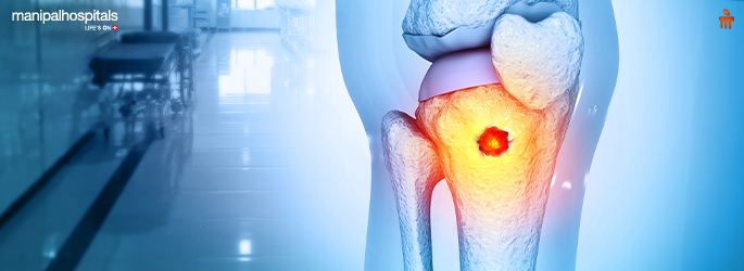 Understanding Bone Cancer Signs and Diagnosis