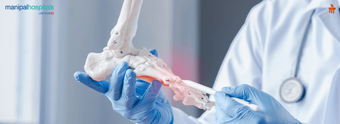 Bone Fracture Treatment 