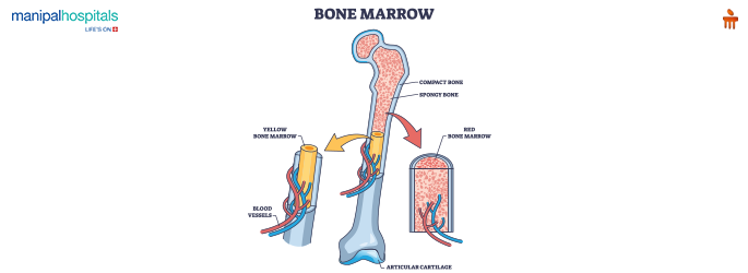 bone marrow transplant a life saving procedure