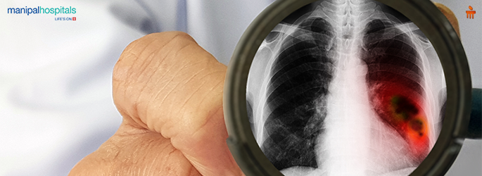 Can Cancer Spread from One Person to Another? Myths vs Facts