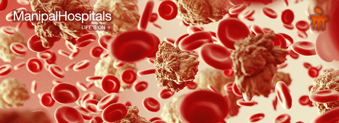 Blood Cancer Treatment In Mangalore