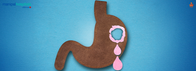Causes of GI Bleeding in Children