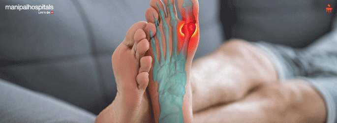 Heel pain sales causes and treatment