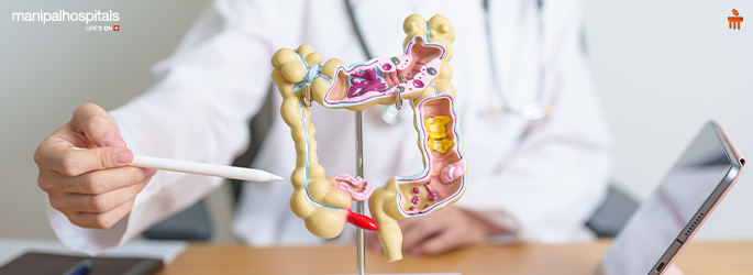 colon cancer symptoms