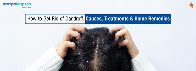 Dandruff treatment and home remedies
