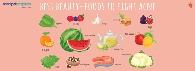 Diet tips for prevention of Acne 