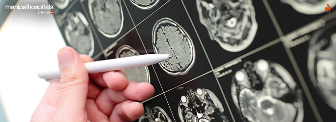 Difference between Benign and Malignant Brain Tumors