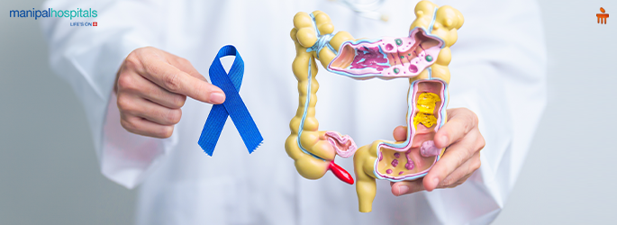 Early Signs of Rectal Cancer