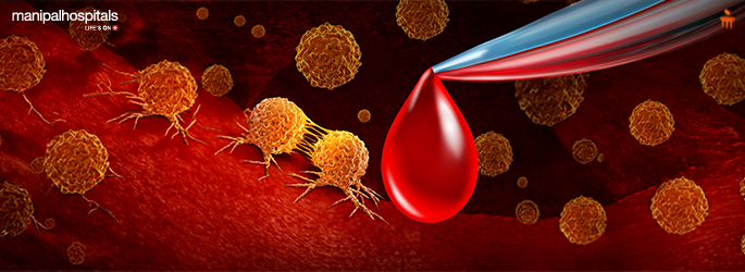 early cancer detection tests