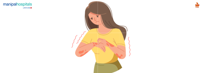 Eczema: Types, Causes, and Treatment Options Available