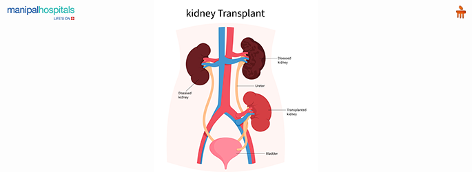 end-stage renal disease treatment