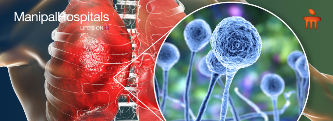 Mucormycosis symptoms