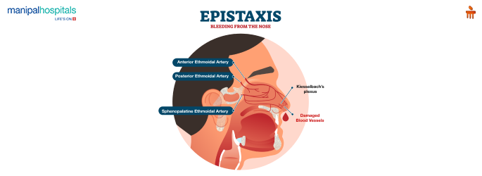 Everything About Nosebleeds or Epistaxis