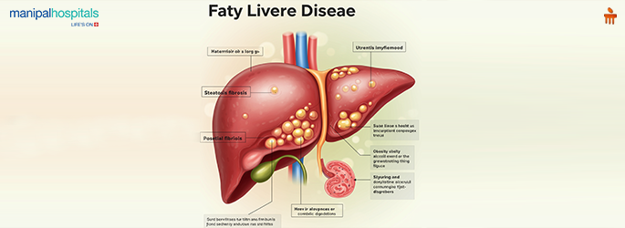 fatty liver disease treatments