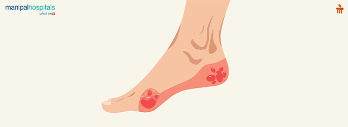 foot ulcer symptoms