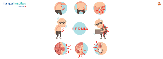 General Surgery Hospital in Goa