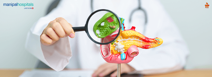 How to Get Rid of Gall Bladder Stones Naturally
