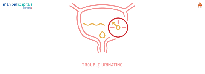 Guide to urine flow blockage