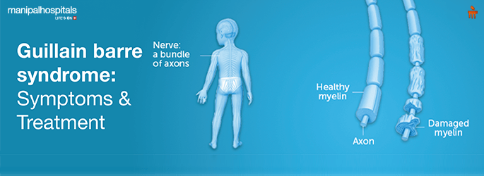 Guillain Barré Syndrome (GBS): Symptoms and Treatment