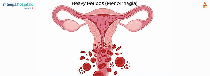 heavy periods