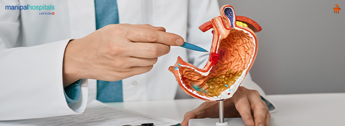 How to Get Rid of Gastritis Permanently