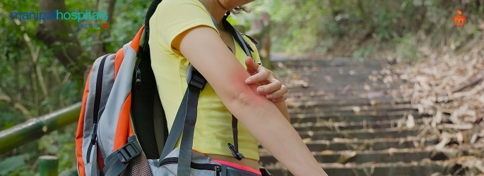 How to Prevent Malaria for Travellers?