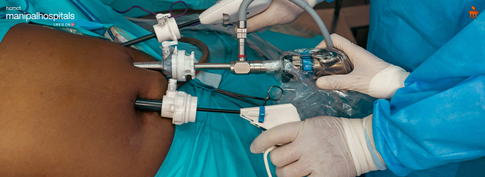 hydatid cyst treatment