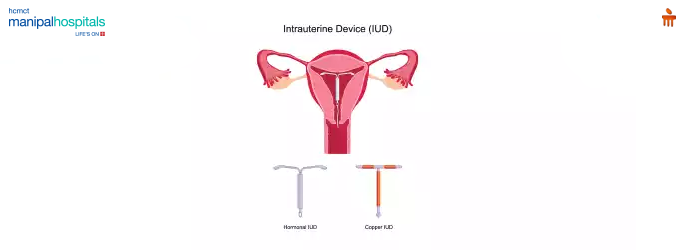 Best obstetrics and gynaecology hospital in Delhi