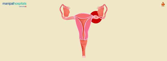 implantation bleeding