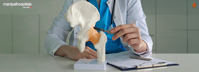 Joint Replacement Surgery: When Is It Needed?