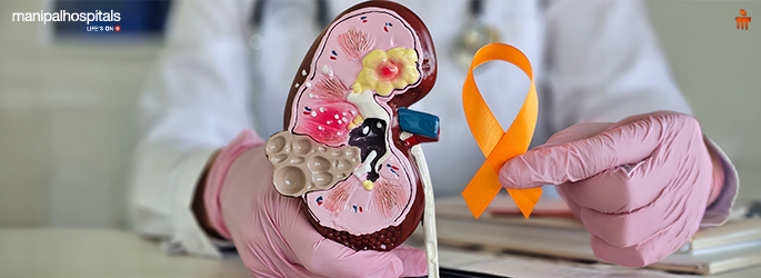 kidney cancer treatment