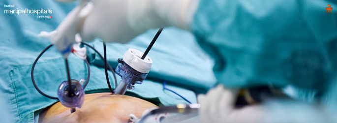 laparoscopic surgery 