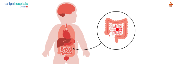 Latest Research and Treatment Options for Pediatric IBS