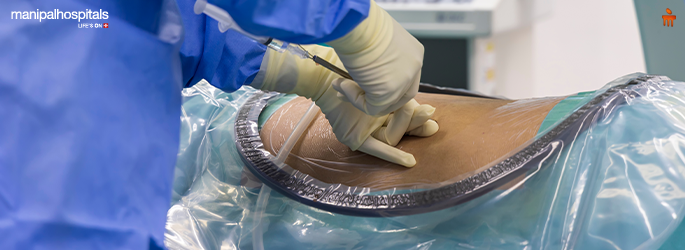 lumbar puncture operation