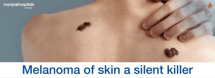 Skin Cancer Symptoms,Causes,Treatment & Preventions 