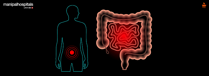 microscopic colitis