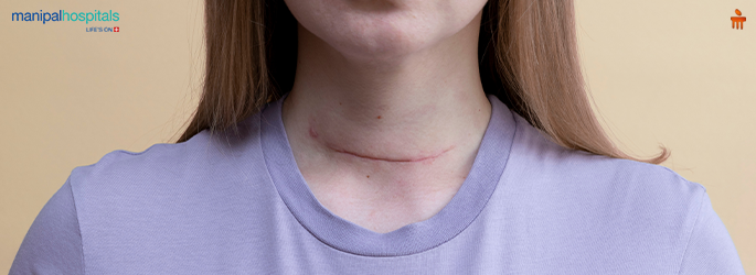 Functional Neck Dissection