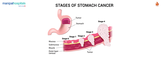 Gastroenterologist Manipal Hospitals