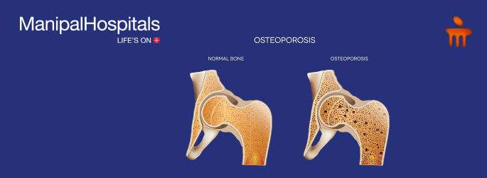 best rheumatologist in Mangalore