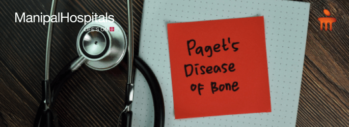 Paget's Disease Of Bone Causes Symptoms and Cures