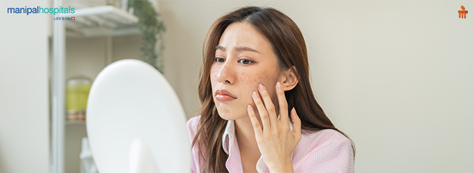 Understanding Pigmentation: Causes, Prevention, and Treatment