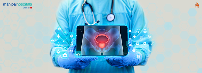 Prostate Cancer Guide: Screening Recommendations & Latest Treatments
