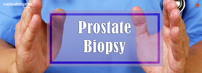 prostate biopsy test