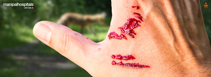 Rabies Infection: Causes, Symptoms, and Prevention