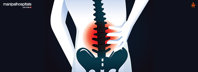 remedies for quick relief from back pain