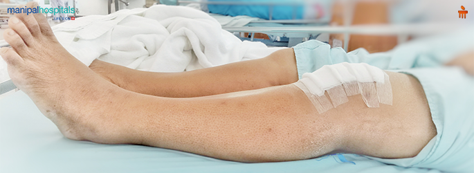 Risks Associated with Knee Replacement Surgery
