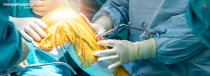 Robotic Knee Replacement: Myths & Facts Explained