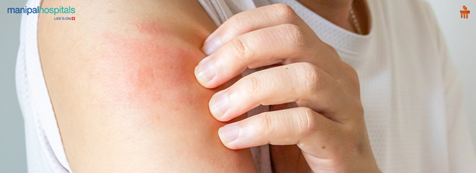 Sensitive Skin in Children: Causes, Care, and When to Seek Help