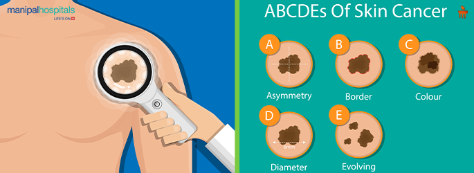 skin cancer symptoms rashes itching